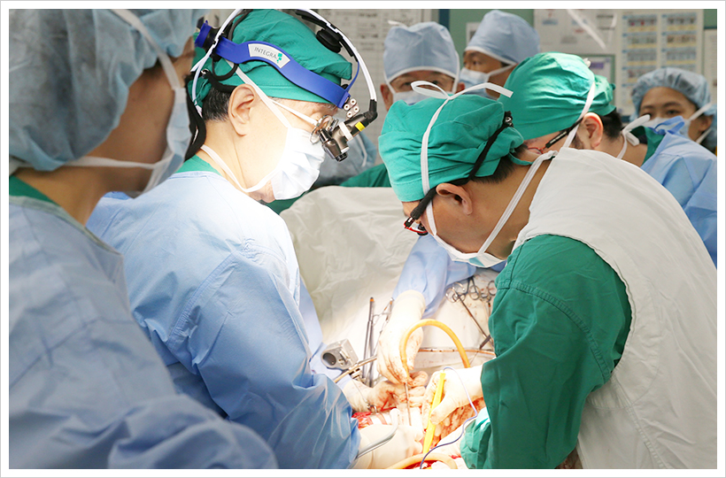 서울아산병원 간이식·간담도외과 이승규 석좌교수(왼쪽 두 번째)가 연간 500번째 간이식 수술을 시행하고 있다.