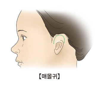 매몰귀