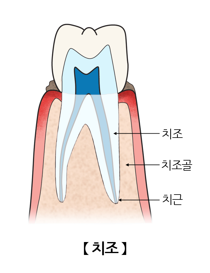 치조(Alveolus ) | 인체정보 | 의료정보 | 건강정보 | 서울아산병원